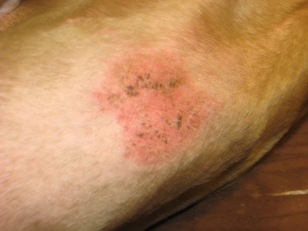 ringworm on stomach #11